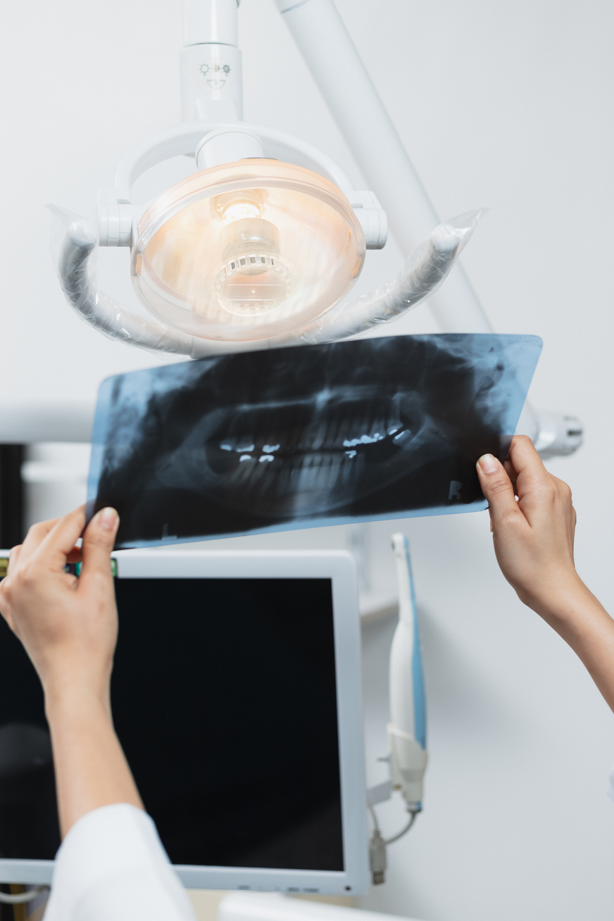 Female Dentist Examining Dental X-ray